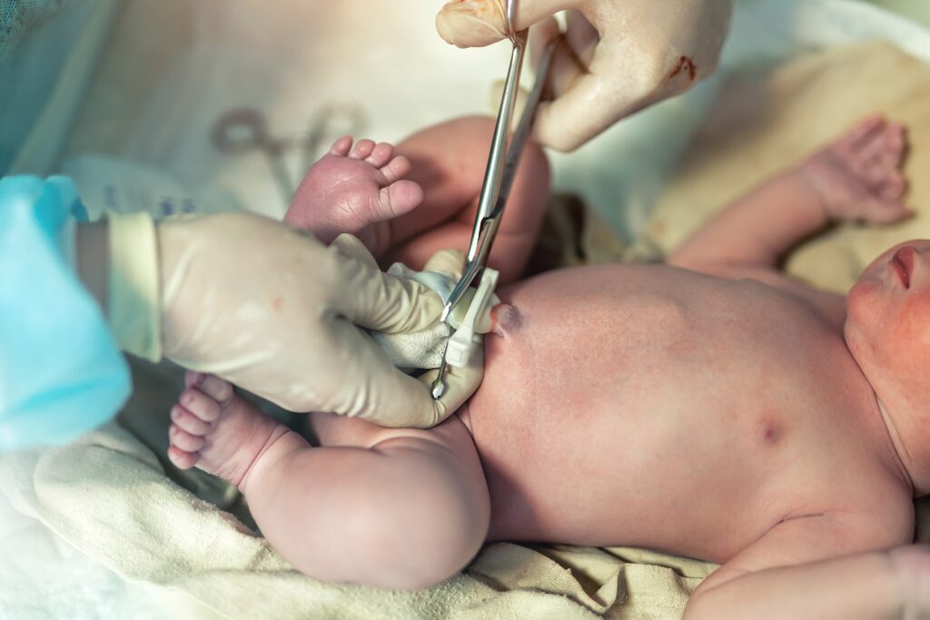 Umbilical cord care