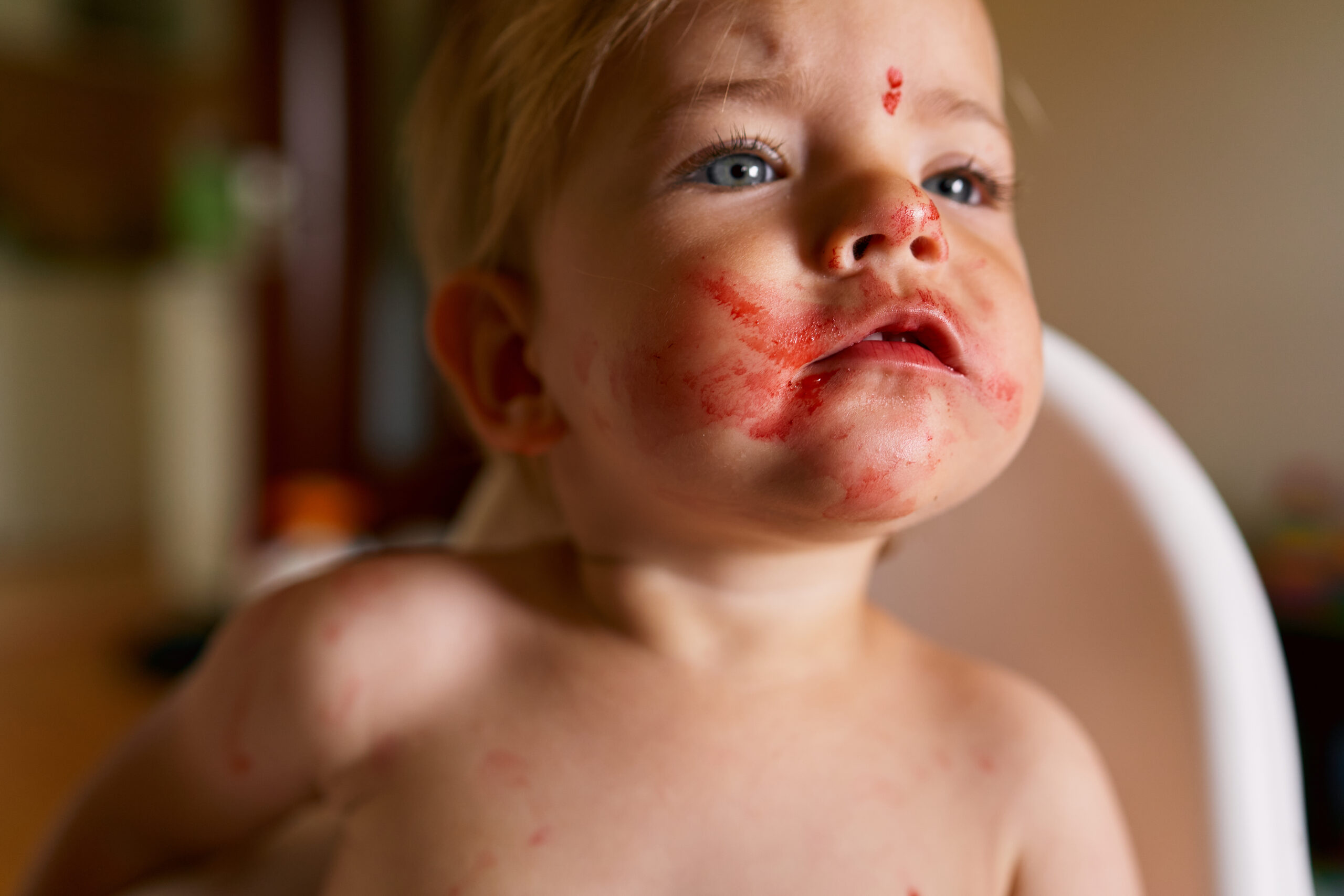 Free Food Allergy & Intolerance Tracker: Monitor Your Child’s Symptoms and Triggers Easily